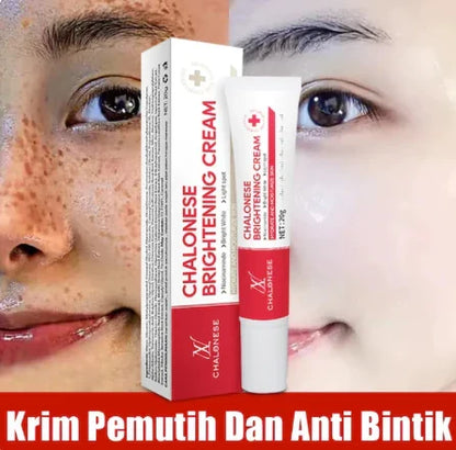 Chalonese Cream | Anti Pigmentation & Acne Cream